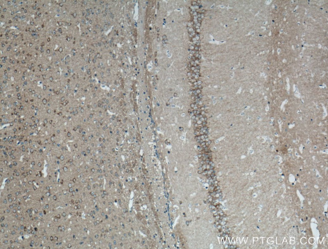 PRKAR1A Antibody in Immunohistochemistry (Paraffin) (IHC (P))