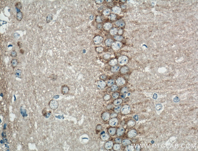 PRKAR1A Antibody in Immunohistochemistry (Paraffin) (IHC (P))