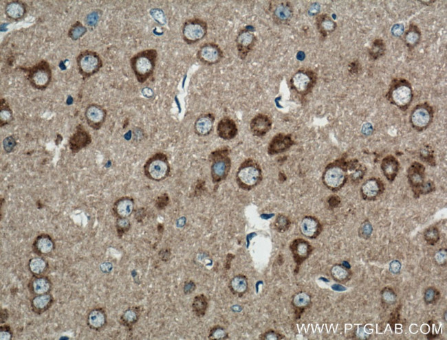 PRKAR1A Antibody in Immunohistochemistry (Paraffin) (IHC (P))