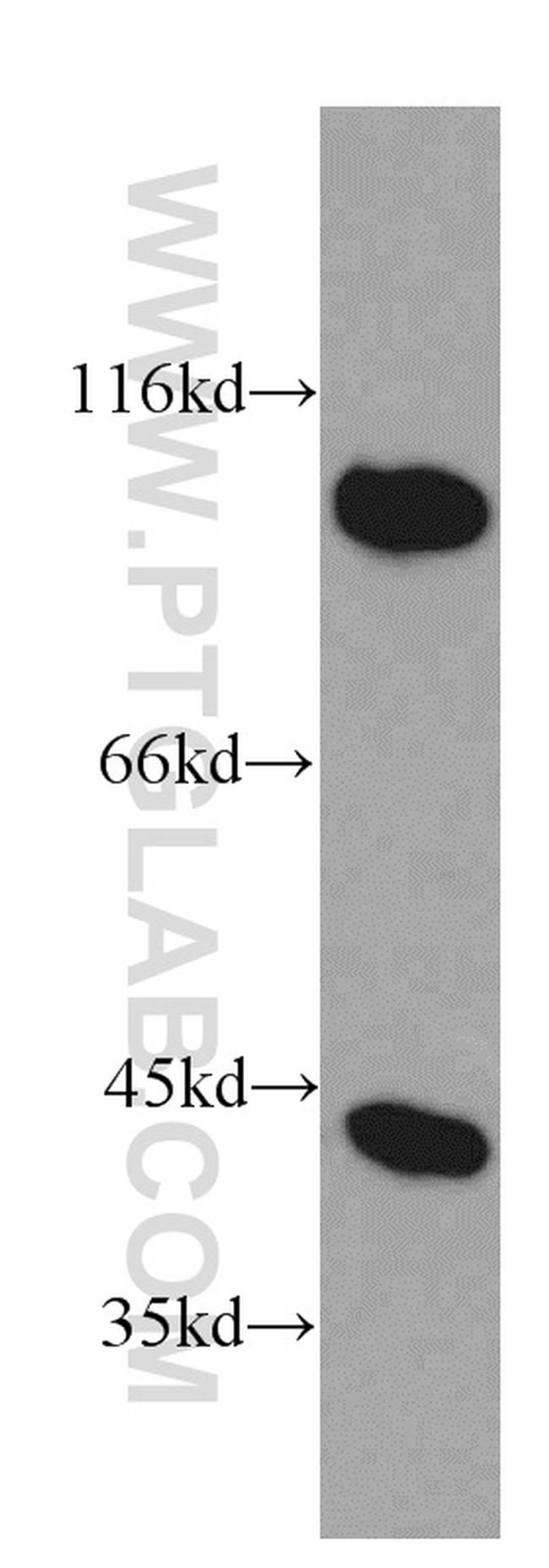 PRKAR1A Antibody in Western Blot (WB)