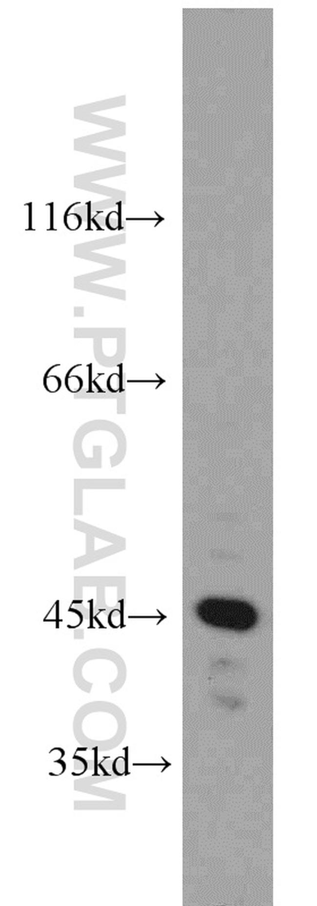 PRKAR1A Antibody in Western Blot (WB)