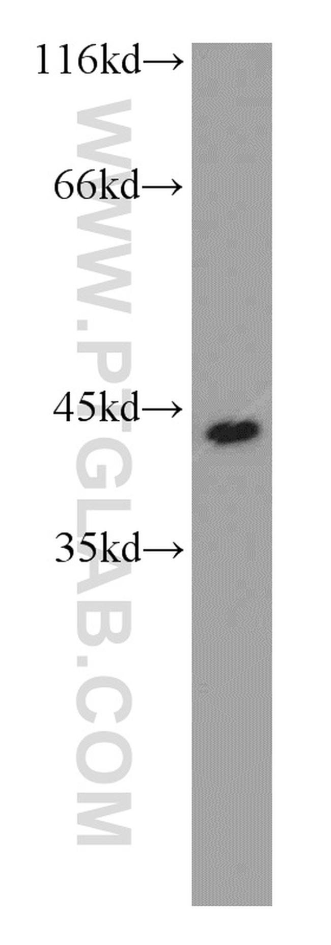 PRKAR1A Antibody in Western Blot (WB)