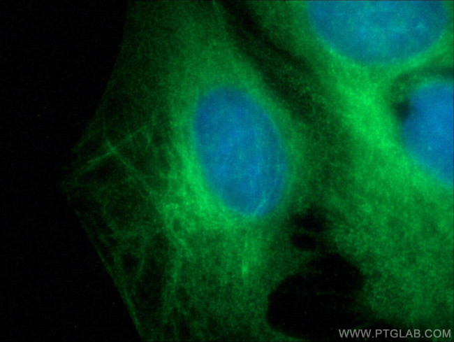 MYOM1 Antibody in Immunocytochemistry (ICC/IF)