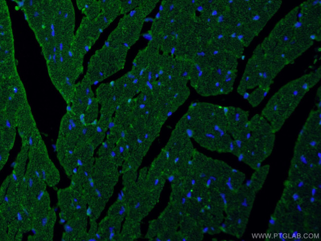 MYOM1 Antibody in Immunohistochemistry (PFA fixed) (IHC (PFA))