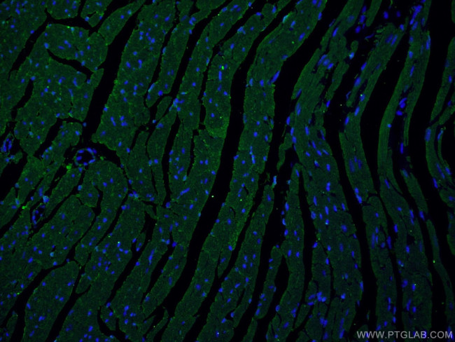 MYOM1 Antibody in Immunohistochemistry (PFA fixed) (IHC (PFA))