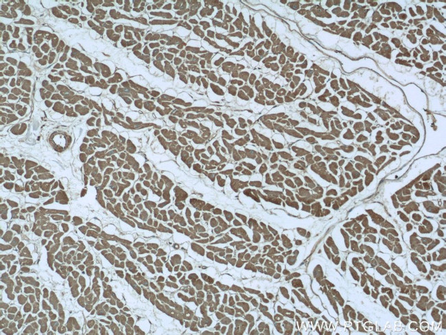 MYOM1 Antibody in Immunohistochemistry (Paraffin) (IHC (P))