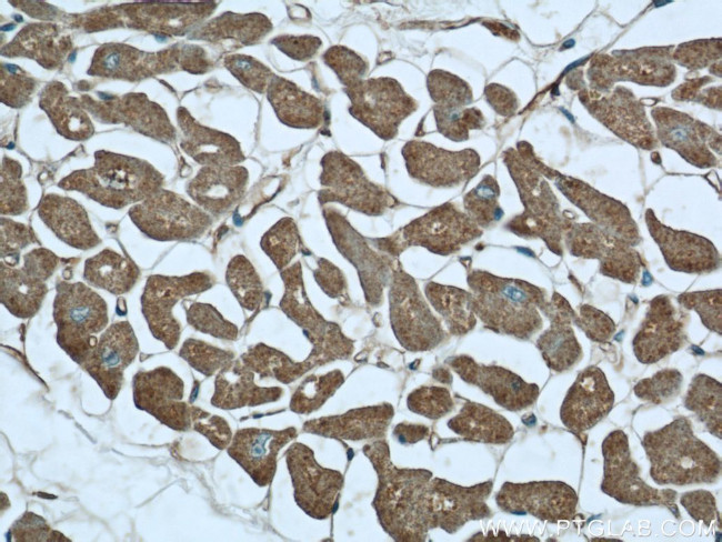 MYOM1 Antibody in Immunohistochemistry (Paraffin) (IHC (P))