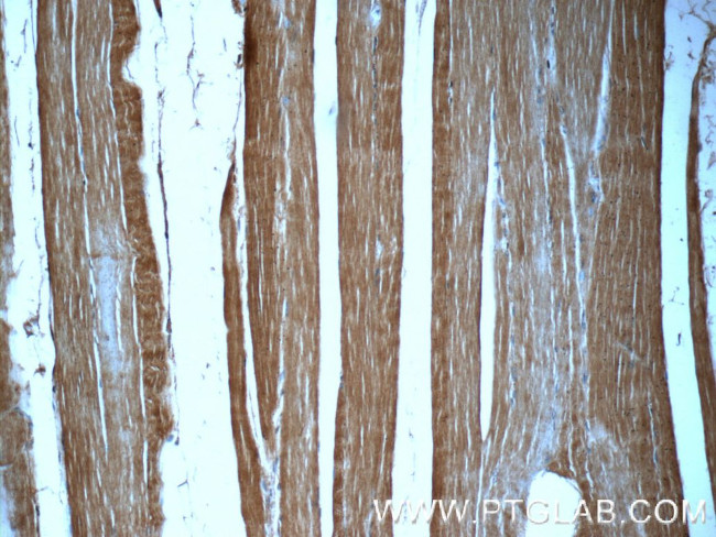 MYOM1 Antibody in Immunohistochemistry (Paraffin) (IHC (P))