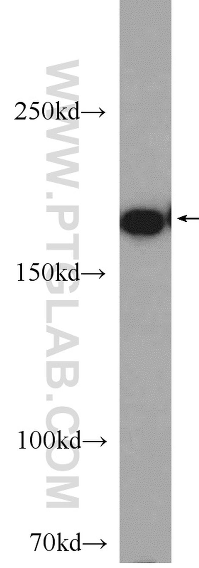 MYOM1 Antibody in Western Blot (WB)