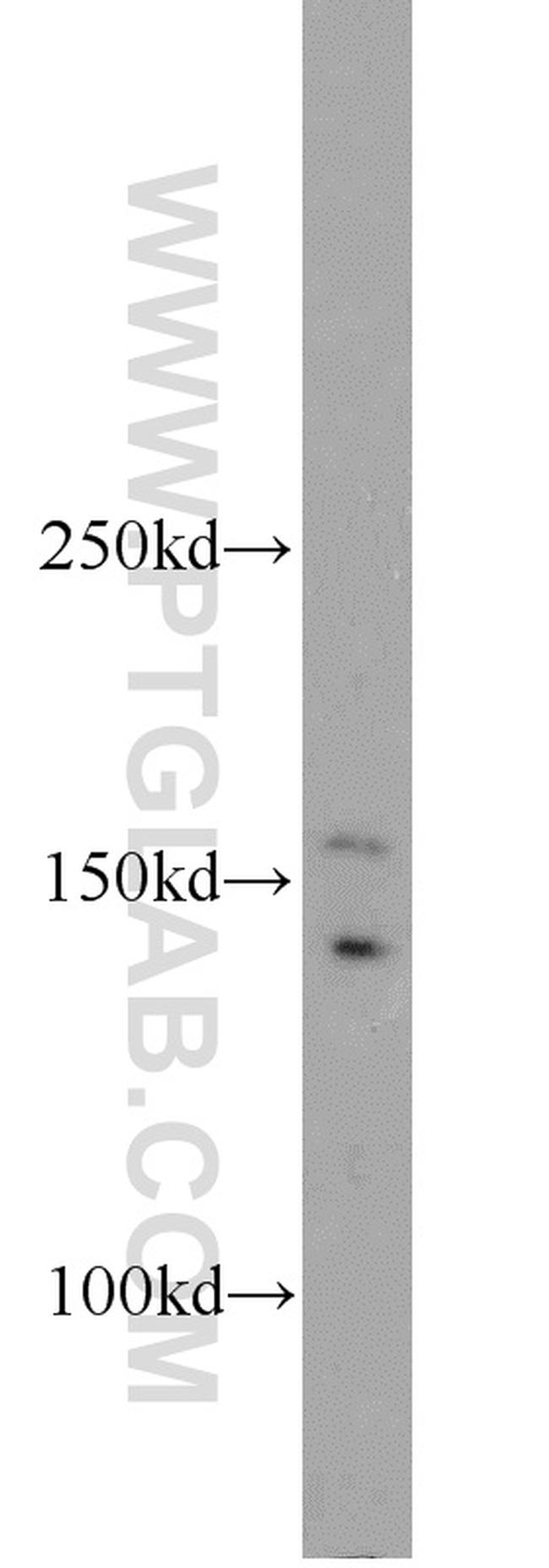 UBN1 Antibody in Western Blot (WB)