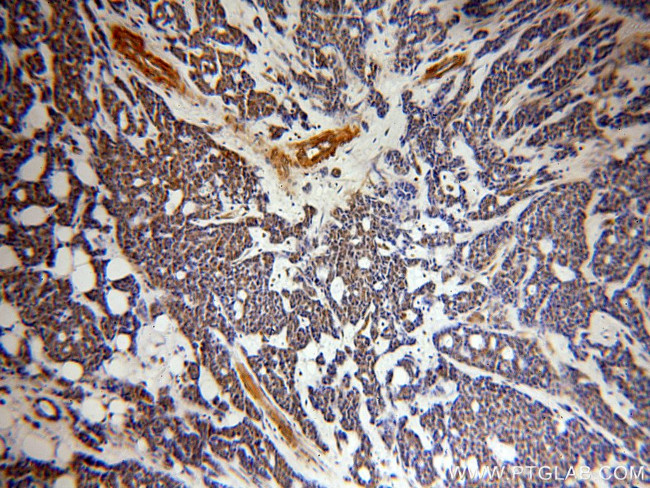 UBN1 Antibody in Immunohistochemistry (Paraffin) (IHC (P))