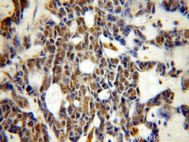 UBN1 Antibody in Immunohistochemistry (Paraffin) (IHC (P))