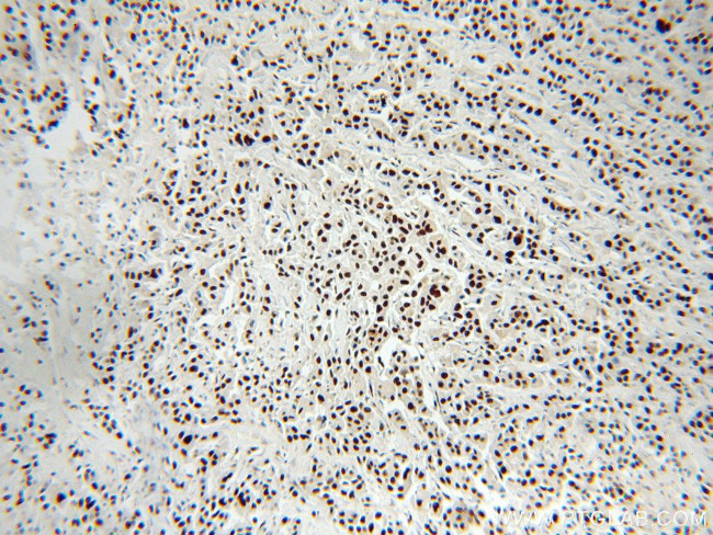 RBAP48 Antibody in Immunohistochemistry (Paraffin) (IHC (P))