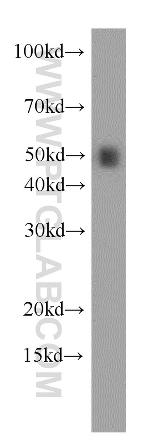 RBAP48 Antibody in Western Blot (WB)