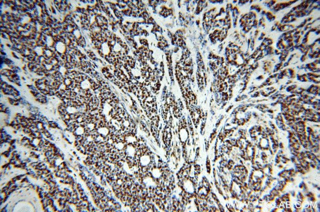 RBAP48 Antibody in Immunohistochemistry (Paraffin) (IHC (P))