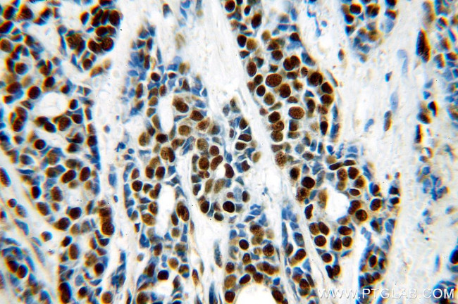 RBAP48 Antibody in Immunohistochemistry (Paraffin) (IHC (P))