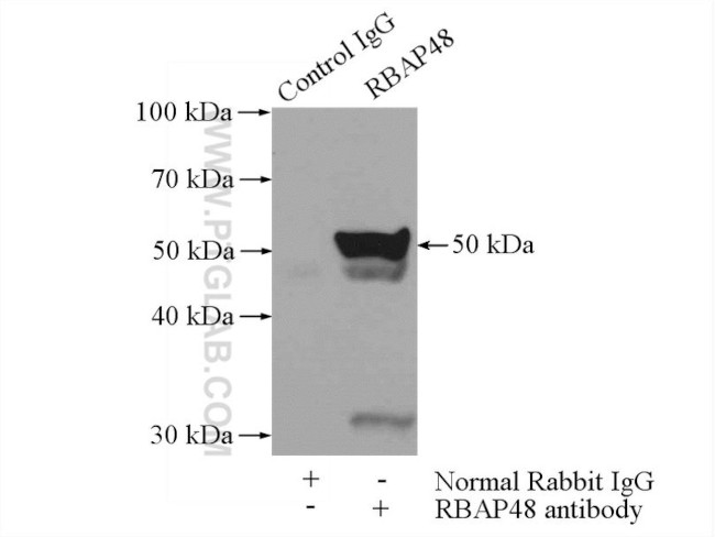RBAP48 Antibody in Immunoprecipitation (IP)