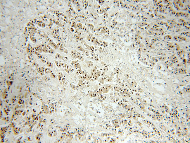 RbAp46 Antibody in Immunohistochemistry (Paraffin) (IHC (P))