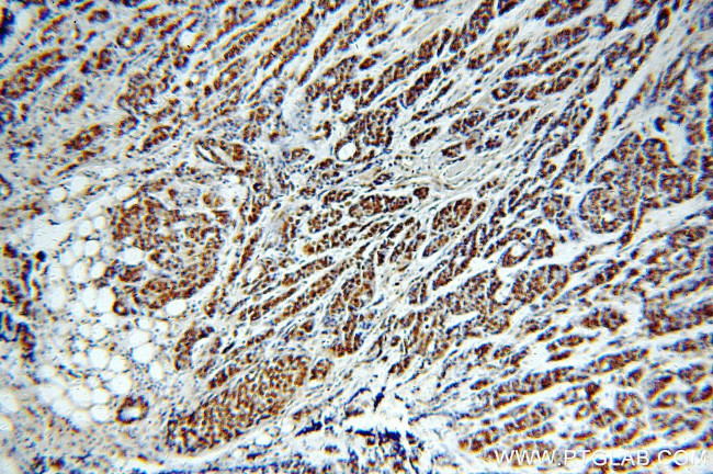 RbAp46 Antibody in Immunohistochemistry (Paraffin) (IHC (P))