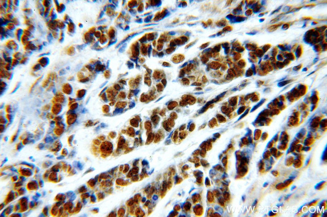 RbAp46 Antibody in Immunohistochemistry (Paraffin) (IHC (P))