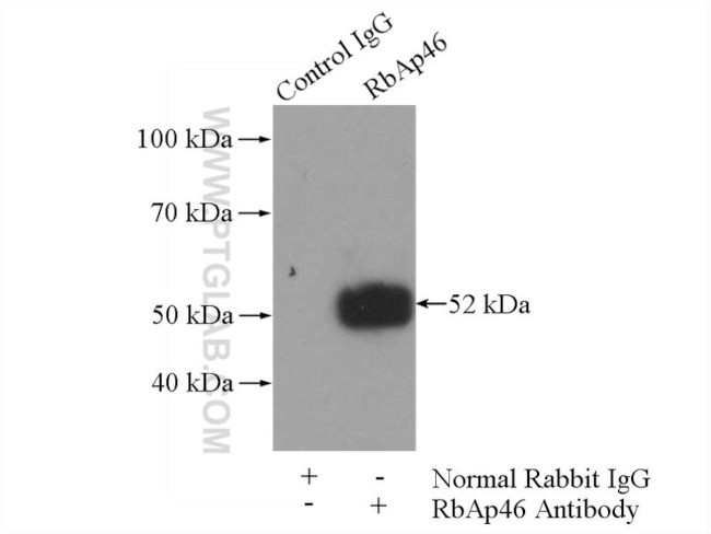 RbAp46 Antibody in Immunoprecipitation (IP)