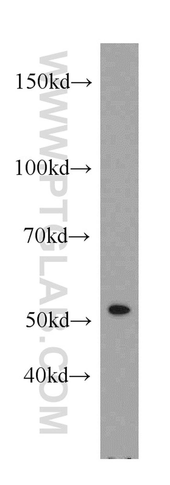 RbAp46 Antibody in Western Blot (WB)