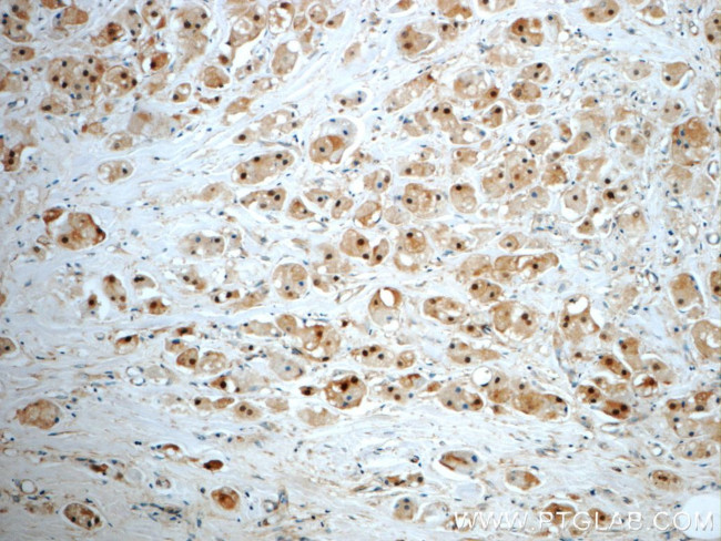 SUZ12 Antibody in Immunohistochemistry (Paraffin) (IHC (P))