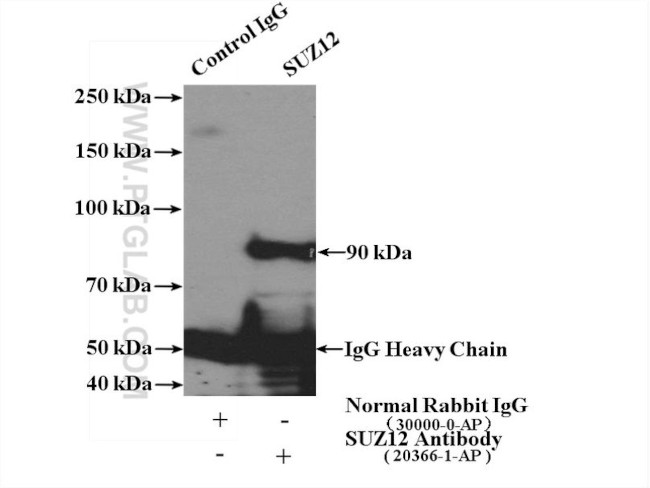 SUZ12 Antibody in Immunoprecipitation (IP)