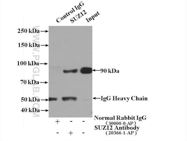 SUZ12 Antibody in Immunoprecipitation (IP)