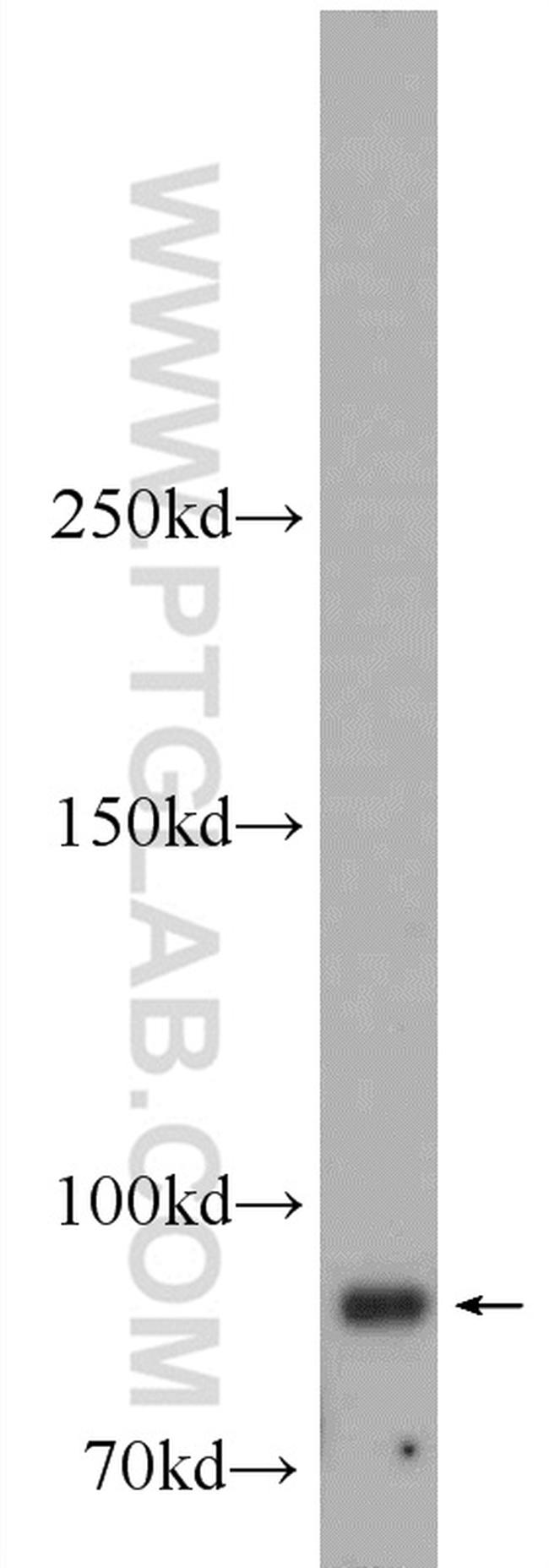 SUZ12 Antibody in Western Blot (WB)