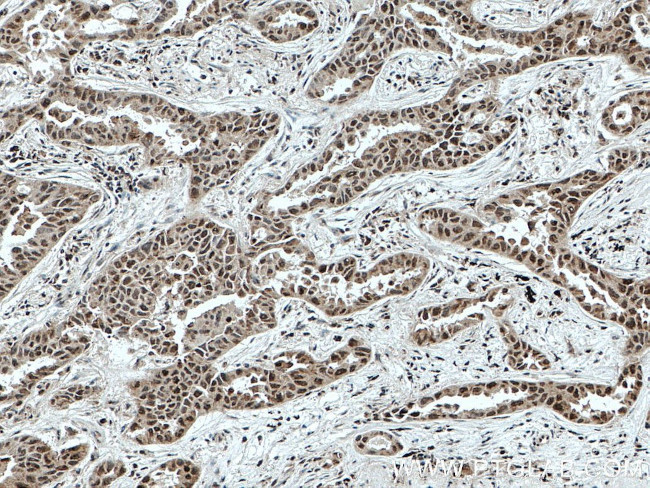 SFRS2 Antibody in Immunohistochemistry (Paraffin) (IHC (P))