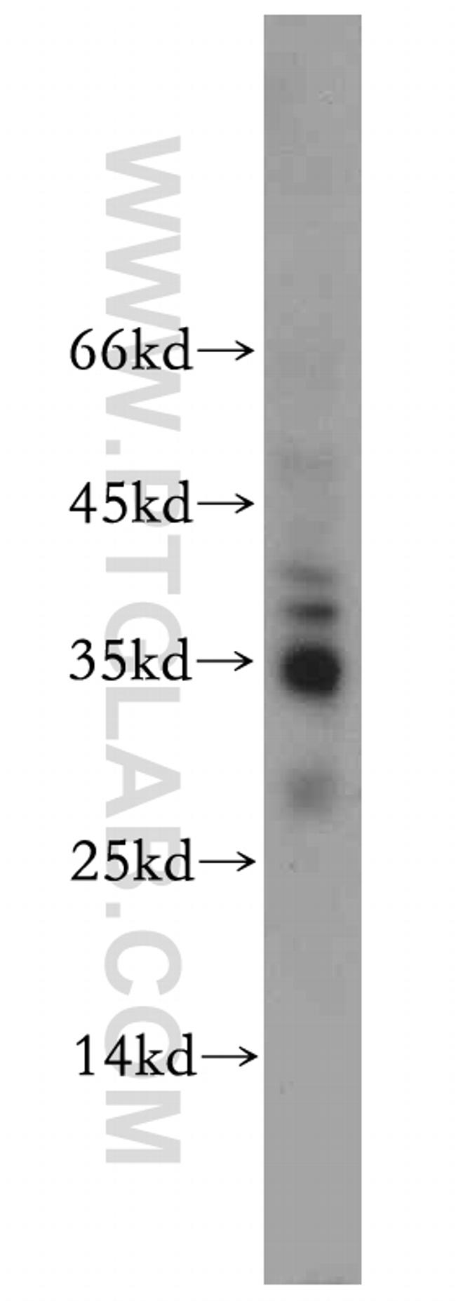 SFRS2 Antibody in Western Blot (WB)