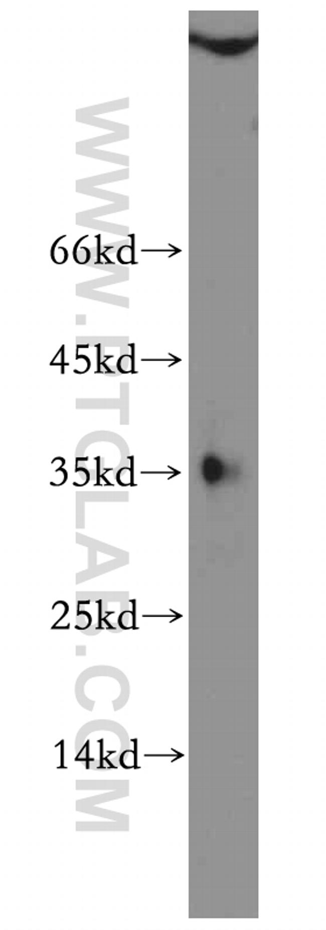 SFRS2 Antibody in Western Blot (WB)