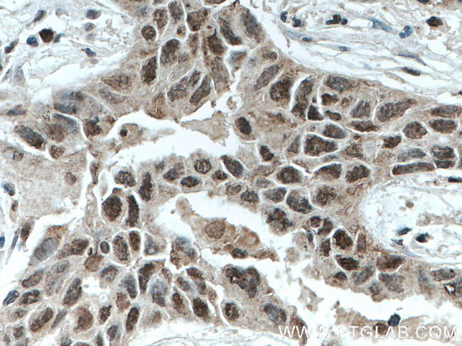 SFRS2 Antibody in Immunohistochemistry (Paraffin) (IHC (P))