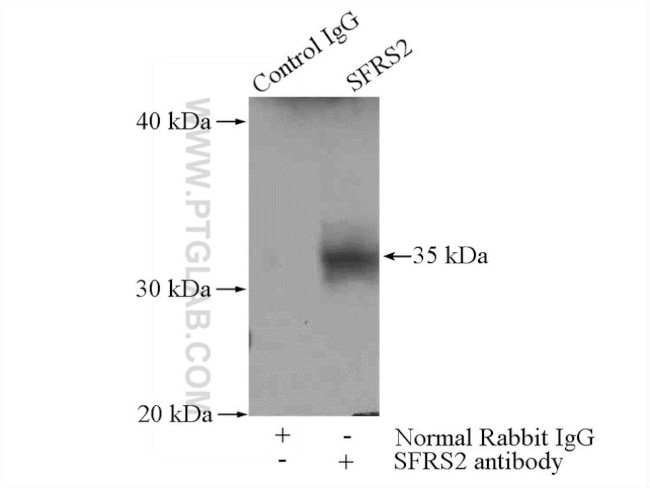 SFRS2 Antibody in Immunoprecipitation (IP)