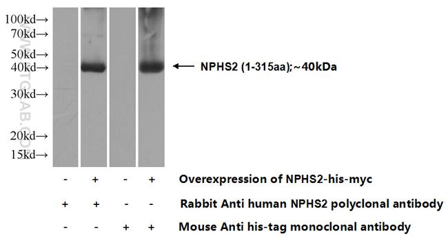 NPHS2 Antibody in Western Blot (WB)