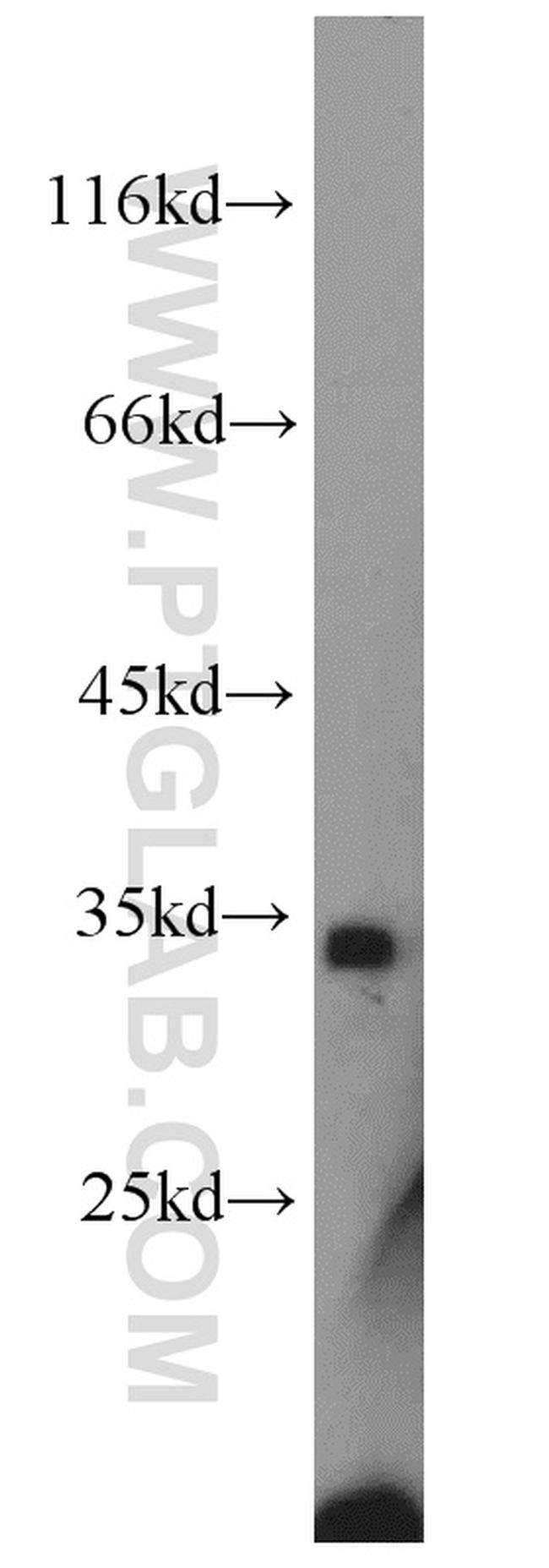 NPHS2 Antibody in Western Blot (WB)