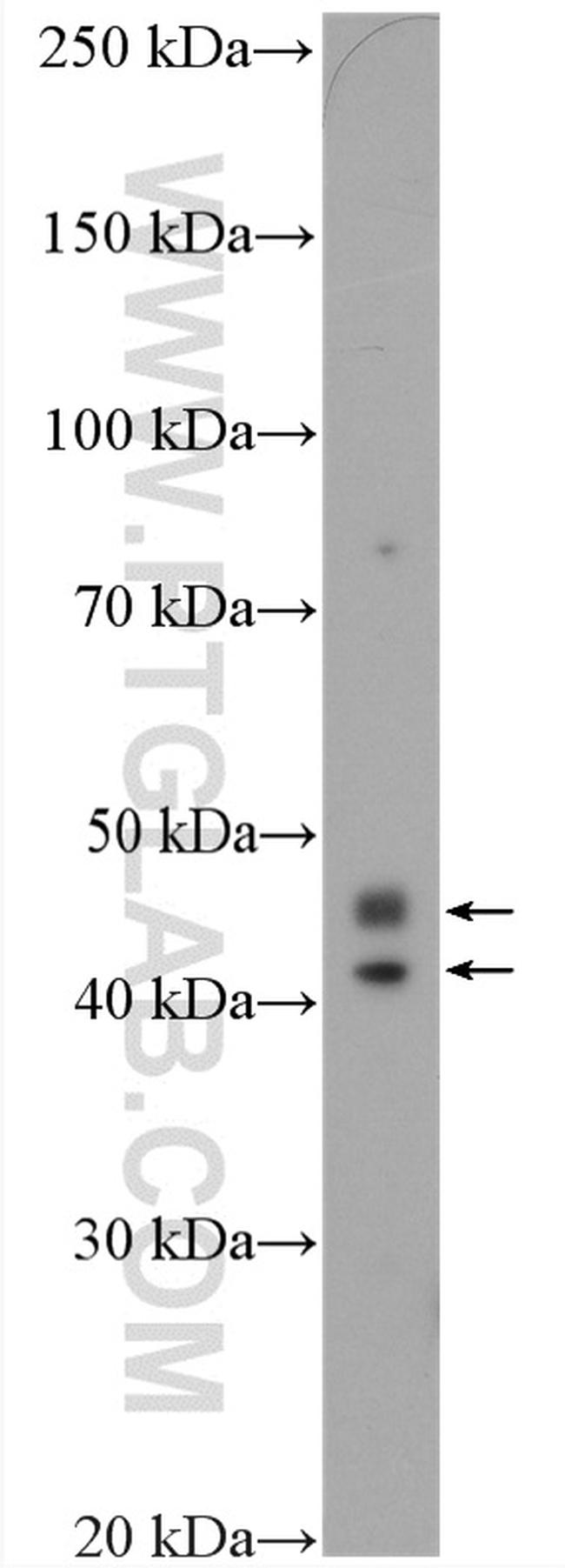 CCDC109B Antibody in Western Blot (WB)