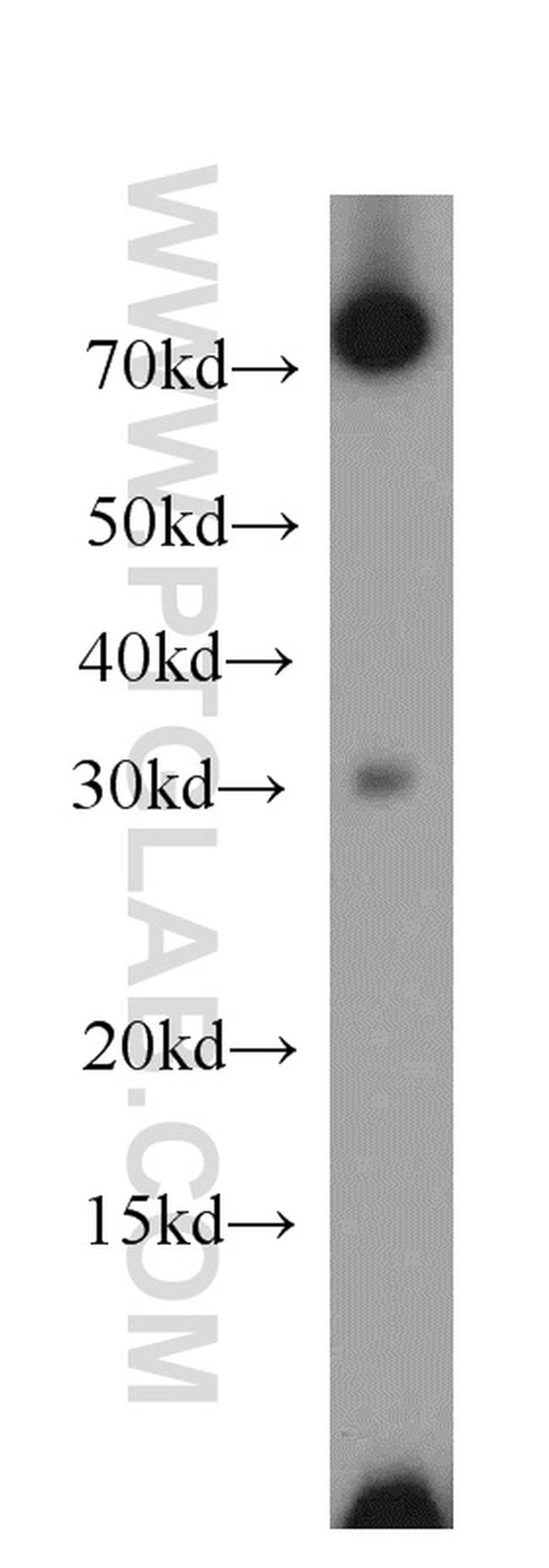 PLEKHF1 Antibody in Western Blot (WB)