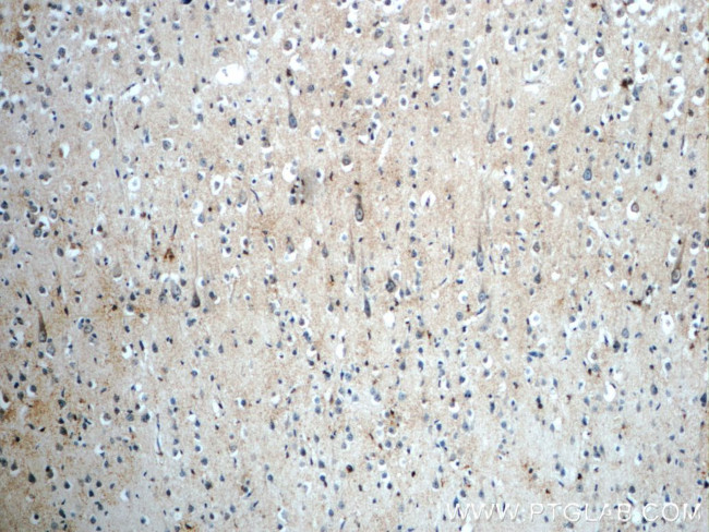 PLEKHF1 Antibody in Immunohistochemistry (Paraffin) (IHC (P))