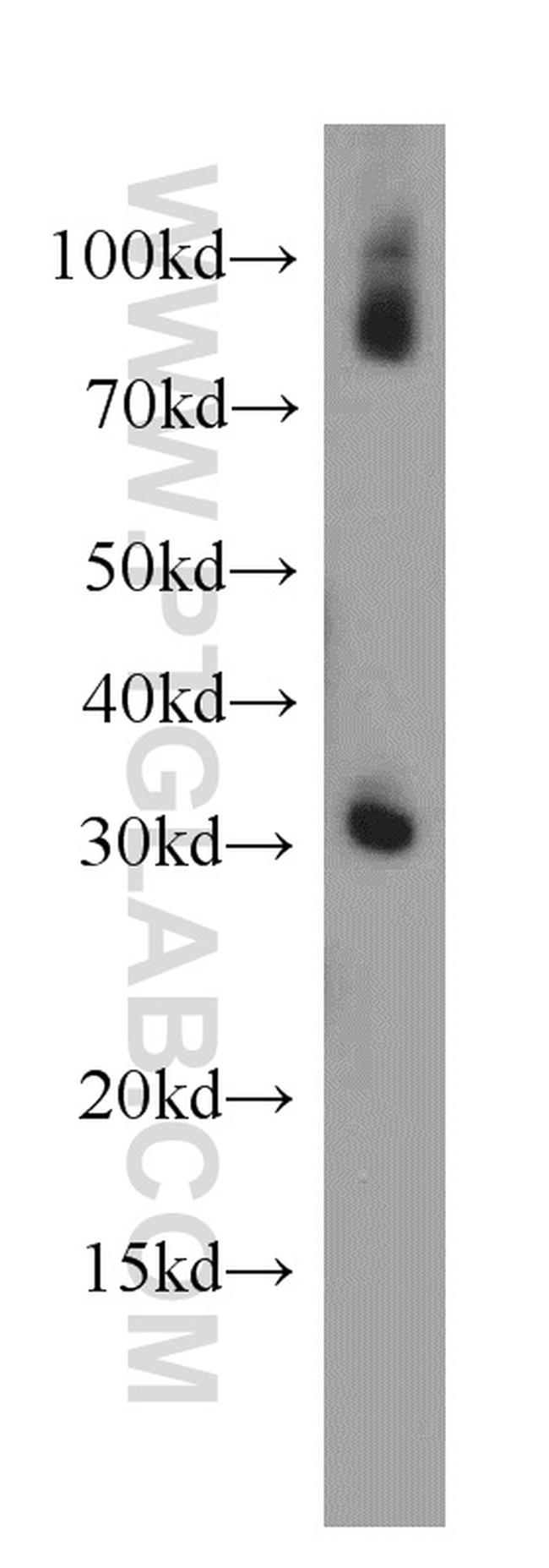 PLEKHF1 Antibody in Western Blot (WB)