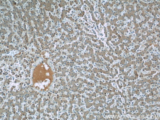 SAA4 Antibody in Immunohistochemistry (Paraffin) (IHC (P))