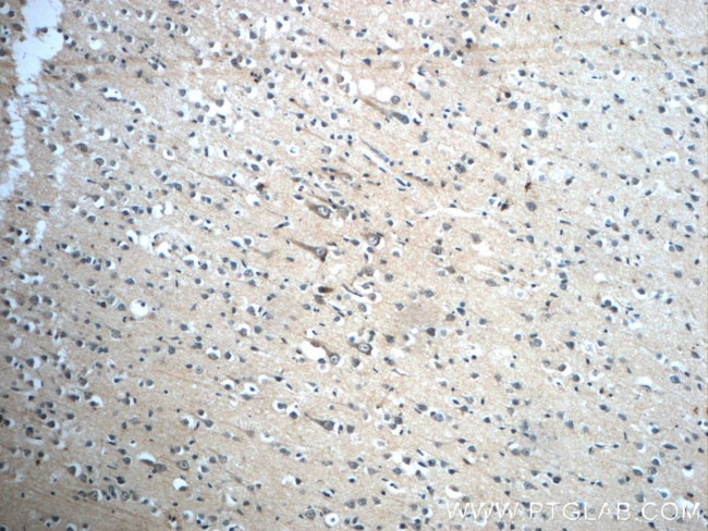 GLUT3 Antibody in Immunohistochemistry (Paraffin) (IHC (P))