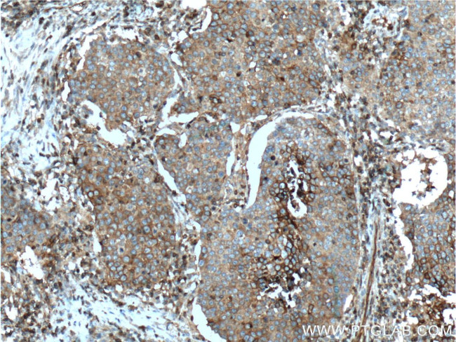 GLUT3 Antibody in Immunohistochemistry (Paraffin) (IHC (P))