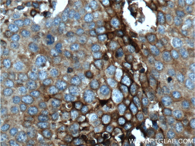 GLUT3 Antibody in Immunohistochemistry (Paraffin) (IHC (P))