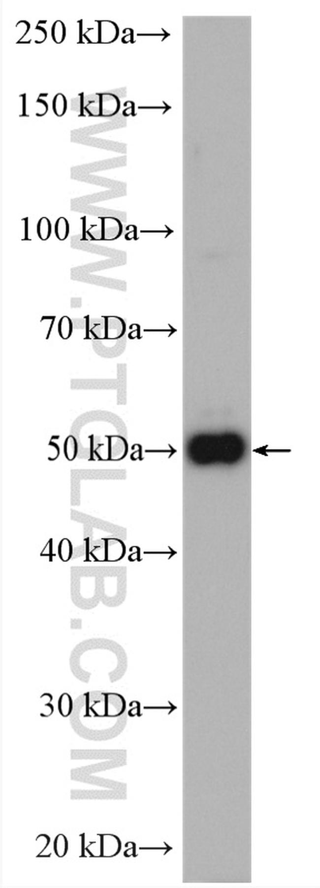 GLUT3 Antibody in Western Blot (WB)