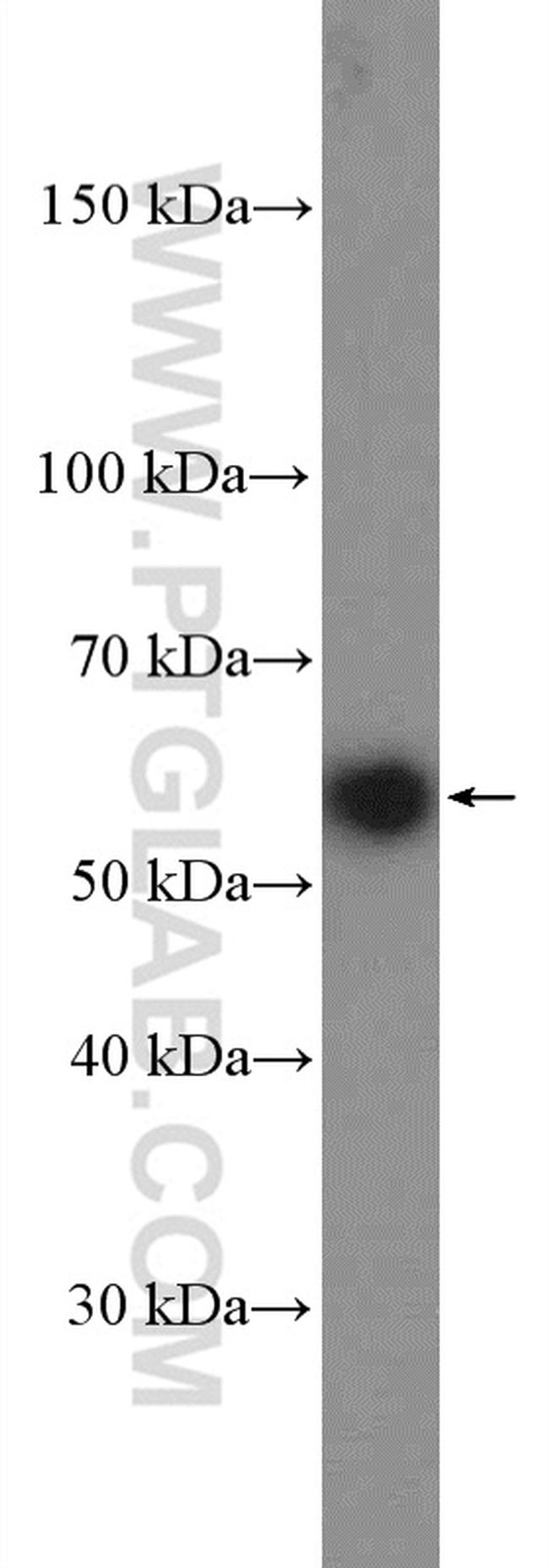 GLUT3 Antibody in Western Blot (WB)