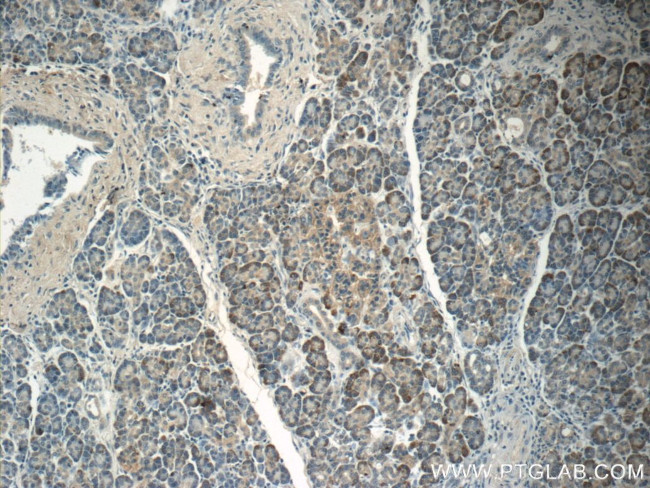 SSTR2 Antibody in Immunohistochemistry (Paraffin) (IHC (P))