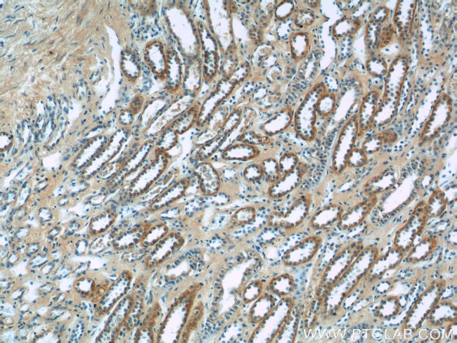 SSTR2 Antibody in Immunohistochemistry (Paraffin) (IHC (P))