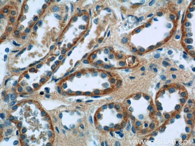 SSTR2 Antibody in Immunohistochemistry (Paraffin) (IHC (P))